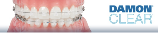 デーモンクリア矯正(透明な表側ワイヤー矯正)のイメージ写真