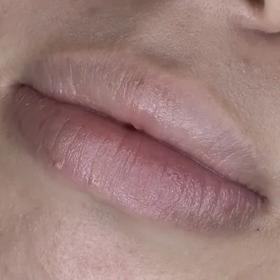 リップアートメイク施術前