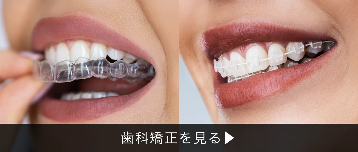 歯科矯正のイメージ画像